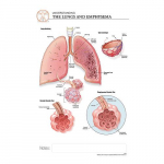 Emphysema "Post It" Chart{part}